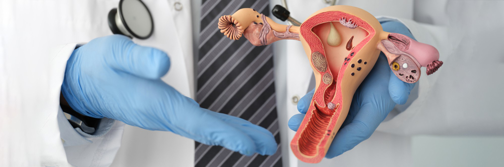 Bladder Cancer