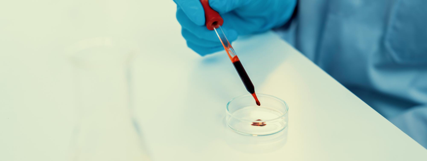 Hematuria (Blood In Urine)