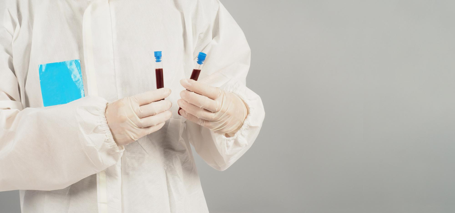 Hematuria (Blood In Urine)